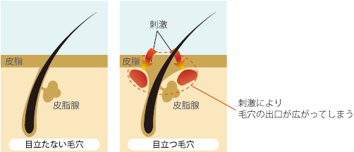 目立たない毛穴と目立つ毛穴